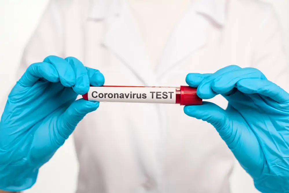 covid 19 coronavirus testing