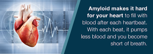 amyloid heart