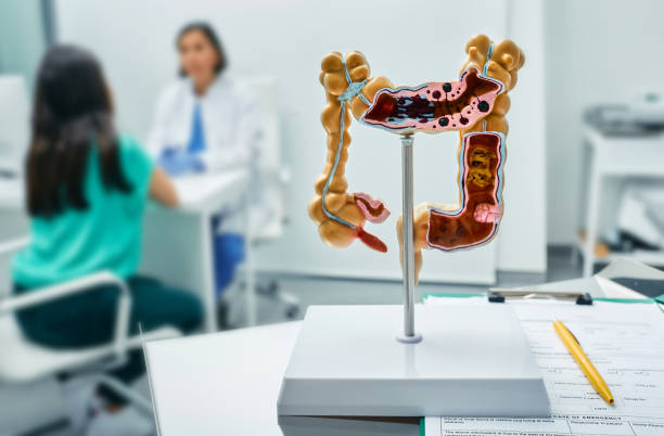 What is Diverticulitis?