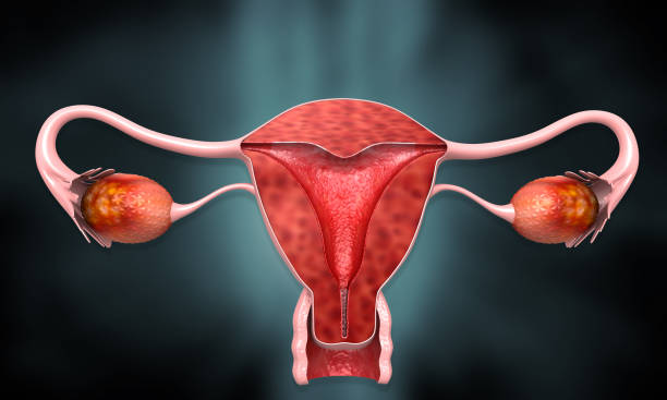 What is Adenomyosis?
