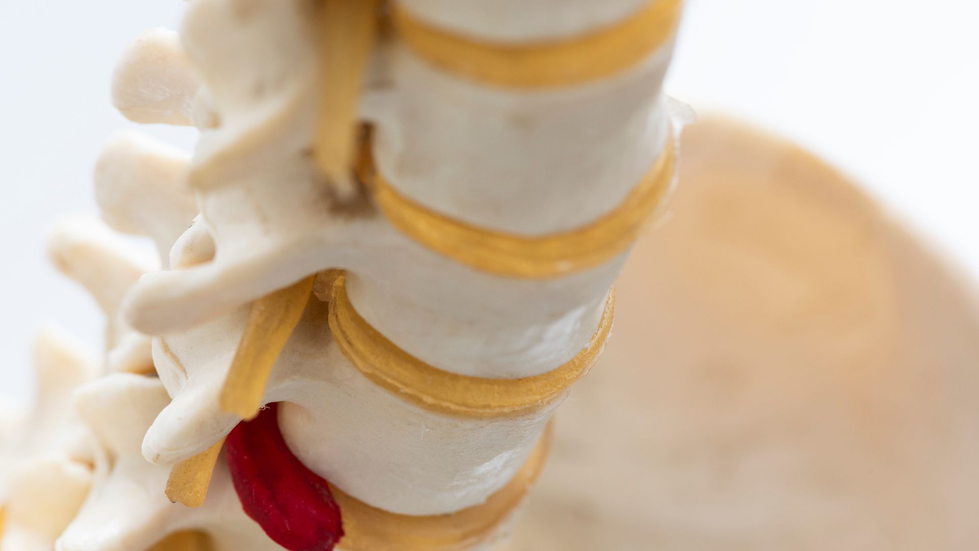 Can You Get Medical Marijuana For a Herniated Disc?